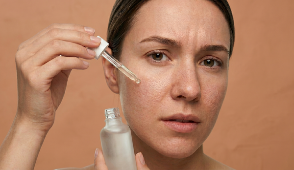 Enlarged Pores